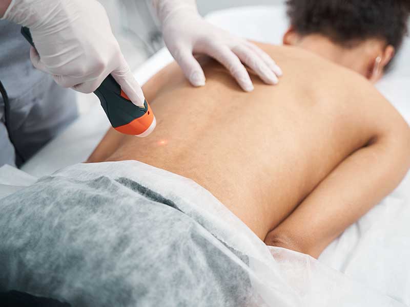 Fisioterapia con laser